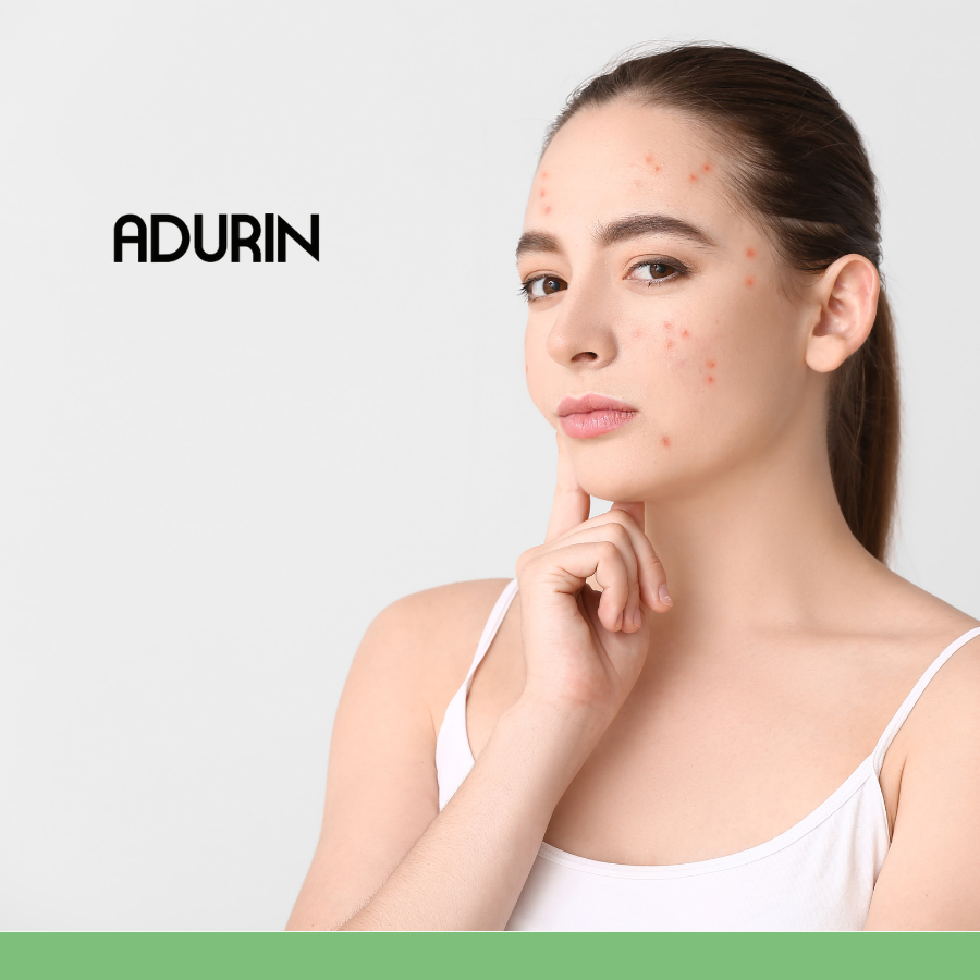 Does Niacinamide cause purging?